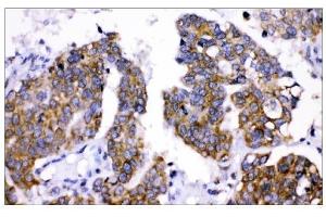 IHC analysis of AMHR2 using anti-AMHR2 antibody (ABIN4886456).