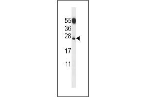 C Antibody (N-term) (ABIN656853 and ABIN2846058) western blot analysis in mouse testis tissue lysates (35 μg/lane). (CT011 Protein 抗体  (N-Term))