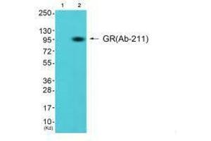 Western blot analysis of extracts from K562 cells (Lane 2), using GR (Ab-211) antiobdy. (Glucocorticoid Receptor 抗体  (Ser211))