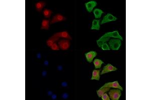 Phospho-JIP1 (Thr103) Antibody staining Hela cells(heat shock treatment) by IF/ICC. (MAPK8IP1 抗体  (pThr103))