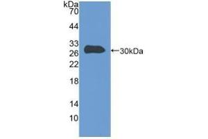 Detection of Recombinant TLN, Human using Polyclonal Antibody to Talin 1 (TLN1) (TLN1 抗体  (AA 2293-2536))