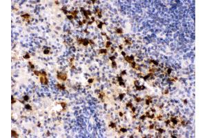 Anti- S100A9 Picoband antibody, IHC(P) IHC(P): Mouse Spleen Tissue