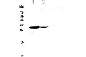 Western blot analysis of IL17C using anti-IL17C antibody . (IL17C 抗体  (AA 19-197))