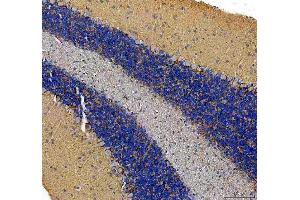 IHC analysis of SLC6A1 using anti-SLC6A1 antibody (ABIN5518957).