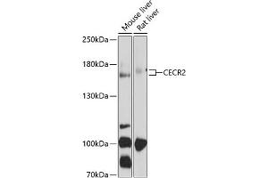 Western blot analysis of extracts of various cell lines, using CECR2 antibody (ABIN6127614, ABIN6138391, ABIN6138392 and ABIN6214290) at 1:1000 dilution. (CECR2 抗体  (AA 170-370))