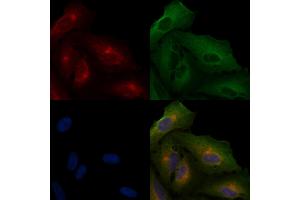 ABIN6265066 and ABIN6266633 staining  cells by IF/ICC. (INPP5D 抗体  (C-Term))