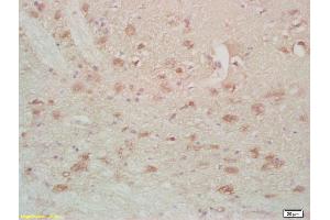 Formalin-fixed and paraffin embedded rat brain labeled with Anti-FABPB Polyclonal Antibody, Unconjugated (ABIN677888) at 1:200, followed by conjugation to the secondary antibody and DAB staining (FABP7 抗体  (AA 1-100))