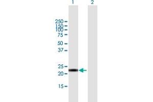 Western Blot analysis of CALML6 expression in transfected 293T cell line by CALML6 MaxPab polyclonal antibody. (CALML6 抗体  (AA 1-181))