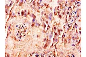 Immunohistochemistry of paraffin-embedded human placenta tissue using ABIN7175388 at dilution of 1:100 (FLT4 抗体  (AA 1112-1329))
