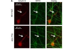 Cultured rat hippocampal neurons (DIV 11-12) were treated for 48 h with 1 μM TTX or its vehicle control (0.