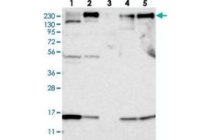 Western blot analysis of Lane 1: RT-4, Lane 2: U-251 MG, Lane 3: Human Plasma, Lane 4: Liver, Lane 5: Tonsil with ARAP2 polyclonal antibody  at 1:250-1:500 dilution.