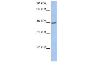 ACADM antibody used at 1 ug/ml to detect target protein. (Medium-Chain Specific Acyl-CoA Dehydrogenase, Mitochondrial (N-Term) 抗体)