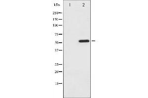 Western Blotting (WB) image for anti-Activating Transcription Factor 2 (ATF2) (pSer112), (pSer94) antibody (ABIN6256110)