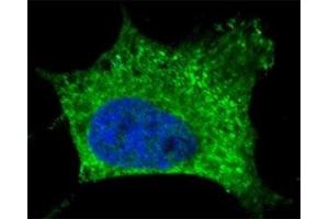 Fluorescent confocal image of SY5Y cells stained with NGFR antibody. (NGFR 抗体)