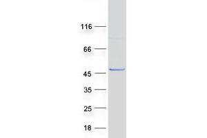 Western Blotting (WB) image for Sperm Associated Antigen 6 (SPAG6) (Transcript Variant 2) protein (Myc-DYKDDDDK Tag) (ABIN2732491)