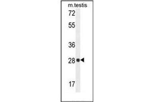 Western blot analysis of PGAM2 Antibody (N-term) in mouse testis tissue lysates (35ug/lane). (PGAM2 抗体  (N-Term))