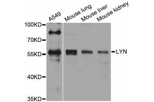 Western blot analysis of extracts of various cell lines, using Lyn antibody. (LYN 抗体)