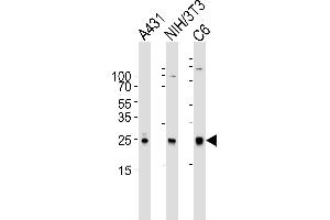 Western blot analysis of lysates from A431, mouse NIH/3T3, rat C6 cell line (from left to right), using RAC1 Antibody (ABIN6242819 and ABIN6577074). (RAC1 抗体)