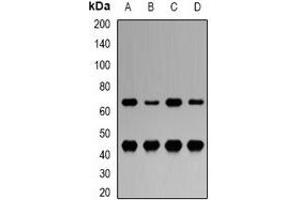 Western blot analysis of LRH-1 expression in MCF7 (A), Hela (B), mouse liver (C), rat liver (D) whole cell lysates. (P2RX5 抗体)