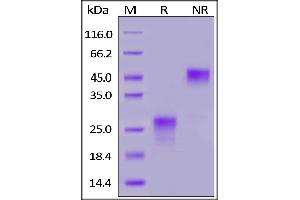 SDS-PAGE (SDS) image for Placenta Growth Factor (PGF) (AA 19-149) (Active) protein (His tag) (ABIN6973196)