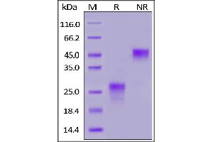 Human PLGF (19-149), His Tag on  under reducing (R) and ing (NR) conditions. (PLGF Protein (AA 19-149) (His tag))