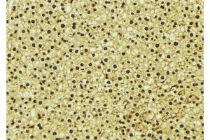 Immunohistochemistry (IHC) image for anti-Proteasome Subunit alpha Type 1 (PSMA1) (C-Term) antibody (ABIN6264468)