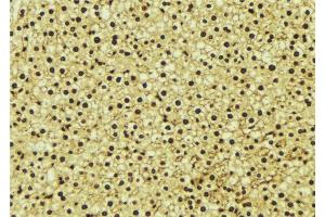 ABIN6277243 at 1/100 staining Mouse liver tissue by IHC-P.