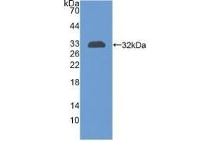 Detection of Recombinant CR1, Human using Polyclonal Antibody to Complement Receptor 1, Erythrocyte (CR1) (CD35 抗体  (AA 1780-2039))