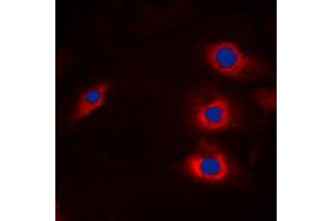 Immunofluorescent analysis of HECW2 staining in A549 cells. (HECW2 抗体  (Center))