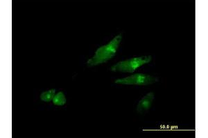 Immunofluorescence of purified MaxPab antibody to SCYL3 on HeLa cell. (SCYL3 抗体  (AA 1-688))