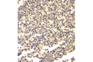 IHC analysis of ATP citrate lyase using anti-ATP citrate lyase antibody (ABIN6719406). (ACLY 抗体  (AA 1-180))