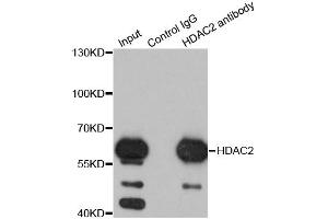 Immunoprecipitation analysis of 200ug extracts of K562 cells using 1ug HDAC2 antibody. (HDAC2 抗体)