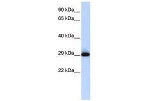 Image no. 1 for anti-Sushi Domain Containing 3 (SUSD3) (AA 35-84) antibody (ABIN6741328) (SUSD3 抗体  (AA 35-84))