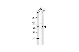 Western Blot at 1:1000 dilution Lane 1: A2058 whole cell lysate Lane 2: K562 whole cell lysate Lysates/proteins at 20 ug per lane. (COPG 抗体  (C-Term))