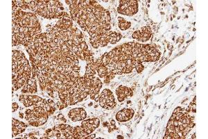 Immunohistochemistry (IHC) image for anti-Cytochrome C Oxidase Subunit Va (COX5A) (Center) antibody (ABIN2855063)