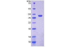 SDS-PAGE analysis of Rat MPP3 Protein. (MPP3 蛋白)