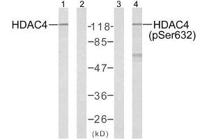 Western blot analysis of extracts from Jurkat cells using HDAC4 (Ab-632) antibody (E021141, Lane 1 and 2) and HDAC4 (phospho-Ser632) antibody (E011192, Lane 3 and 4) . (HDAC4 抗体)
