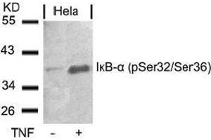 Image no. 3 for anti-Nuclear Factor of kappa Light Polypeptide Gene Enhancer in B-Cells Inhibitor, alpha (NFKBIA) (pSer32), (pSer36) antibody (ABIN196875) (NFKBIA 抗体  (pSer32, pSer36))