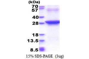 SDS-PAGE (SDS) image for RAD51 Homolog D (RAD51D) (AA 1-216), (Iso4) protein (His tag) (ABIN5853478) (RAD51D Protein (AA 1-216, Iso4) (His tag))