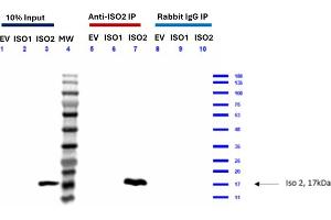 Feimin (Isoform 2) Immunoprecipitation (IP) followed by Western Blot (WB) analyses. (Feimin (N-Term) 抗体)