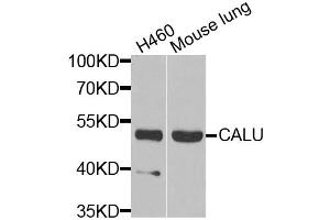Western blot analysis of extracts of various cell lines, using CALU antibody (ABIN5973922) at 1/1000 dilution. (CALU 抗体)