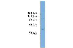 TNNI3K antibody used at 1 ug/ml to detect target protein. (TNNI3K 抗体  (N-Term))