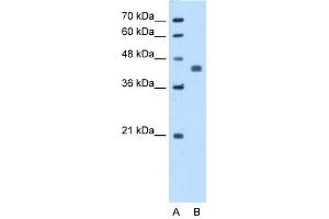 WB Suggested Anti-PDHA1 Antibody Titration:  5. (PDHA1 抗体  (N-Term))