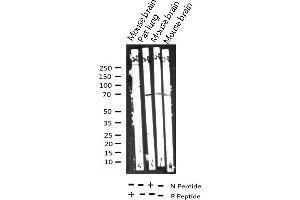 Western blot analysis of Phospho-Shc (Tyr427) expression in various lysates
