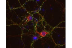 Indirect immunostaining of PFA fixed rat hippocampus neurons with anti-HCN 1 (dilution 1 : 500; red) and mouse anti-synapsin 1 (cat. (HCN1 抗体)