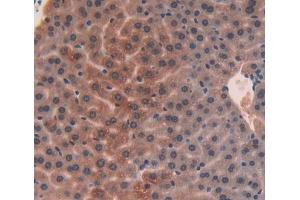 Used in DAB staining on fromalin fixed paraffin- embedded liver tissue (UQCRB 抗体  (AA 3-111))