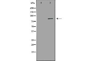 Western Blotting (WB) image for anti-Amine Oxidase, Copper Containing 3 (Vascular Adhesion Protein 1) (AOC3) (Internal Region) antibody (ABIN6259958)