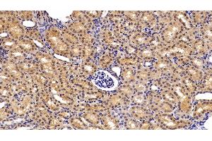 Immunohistochemistry (IHC) image for anti-Glutathione S-Transferase alpha 2 (GSTa2) (AA 1-222) antibody (ABIN7434407)