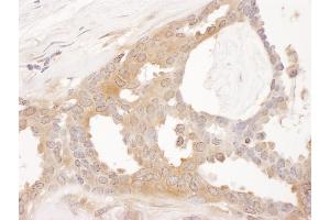 Immunohistochemistry (IHC) image for anti-Chaperonin Containing TCP1, Subunit 8 (Theta) (CCT8) (AA 1-50) antibody (ABIN7453618) (CCT8 抗体  (AA 1-50))