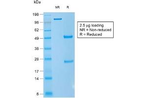 SDS-PAGE analysis of purified, BSA-free recombinant CD1a antibody (clone rC1A/711) as confirmation of integrity and purity. (CD1a 抗体)